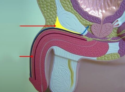 пайвандҳои penile